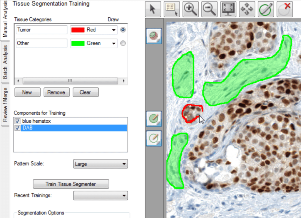 Tissue segmentation training in inForm