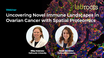 Akoya Webinar Uncovering Novel Immune Landscapes in Ovarian Cancer with Spatial Proteomics 367x206 1