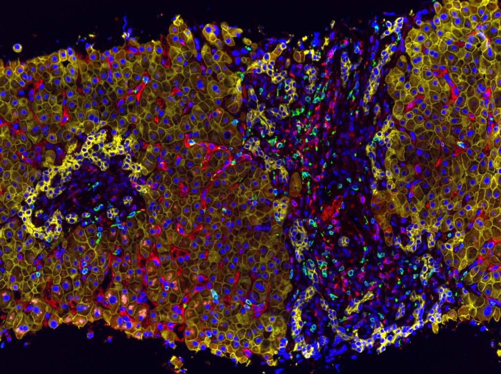 cell defence liver biopsy hires 1024x765 image