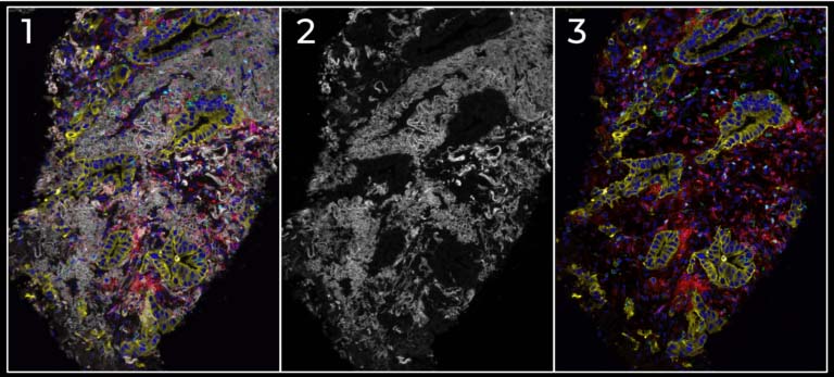 cell defence lung biopsy hires 768x347 image