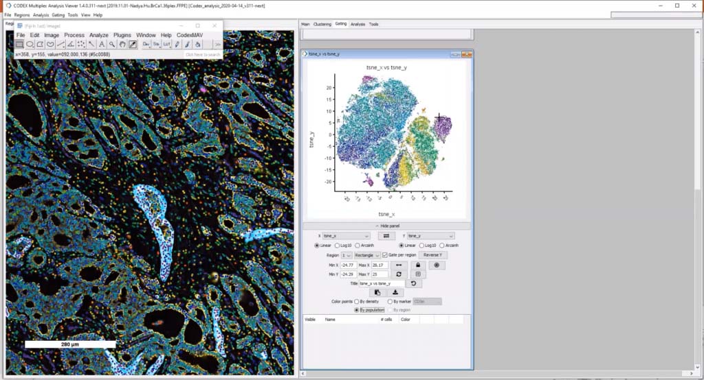 mav tsne breast cancer 1024x554