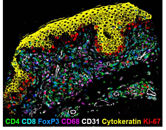 nolan CTCL CODEX img