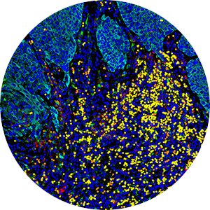 Deep Spatial Analysis