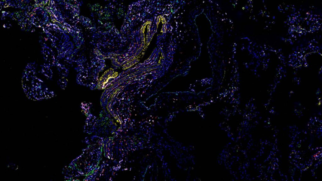 zeiss Human Lung Imaged With 37 antibody codex panel inset @2x