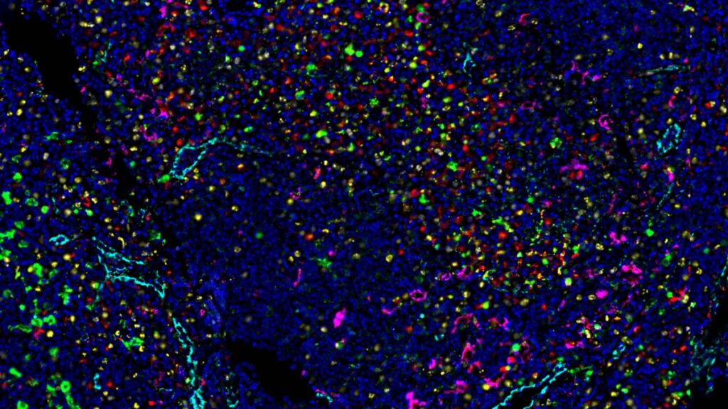 zeiss Human lymph node imaged with 14 antibody codex panel inset @2x